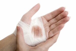Chiêm bao thấy mình bị thương nặng báo hiệu bạn đang bị lợi dụng